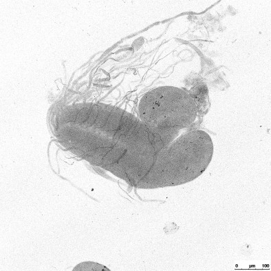Microscope image of the small male larval brain of a hybrid of two fruit fly species. Cell division stops, so male hybrid larvae die during the transition to the pupal stage and never become adults.