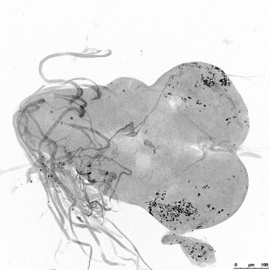 By disabling a gene that kills or sterilizes the hybrid offspring of two fruit fly species, University of Utah-led researchers “rescued” a male hybrid fruit fly that normally would have died in its larval stage. Black dots in this image of its brain show cells are dividing normally.